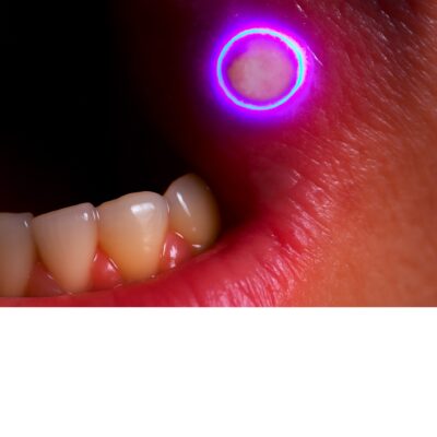 Webinar: Die Mundschleimhaut im Wandel